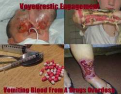 Voyeurestic Engagement : Vomiting Blood from a Drugs Overdose